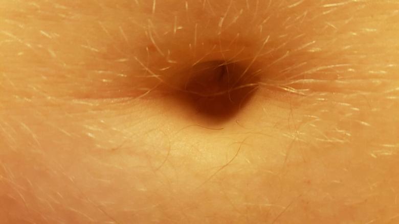 Bauchnabel